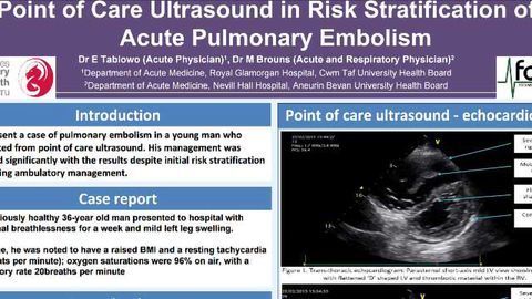 Point of Care Ultrasound in Risk Stratification of Acute Pulmonary Embolism