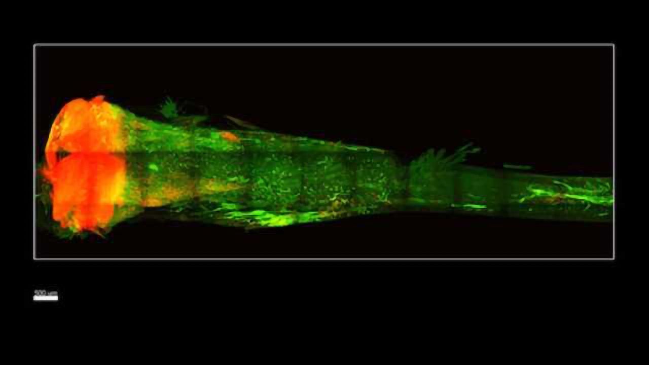 New Technique Makes Bones Transparent