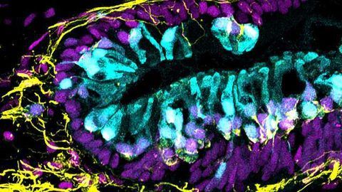 Stem Cells Used to Create Inner Ear Organoids