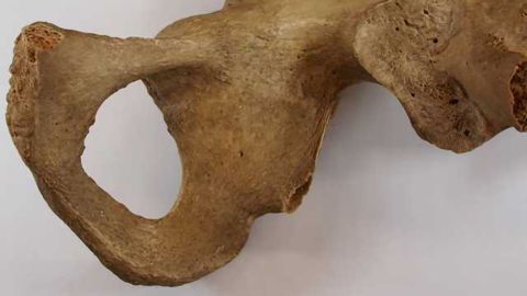 Flawed Forensic Method May Be Hampering the Identification of Human Remains