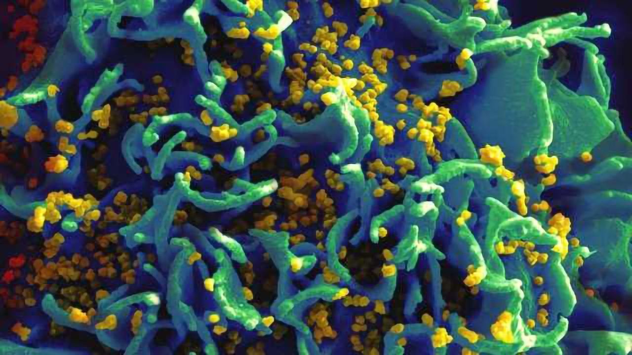 CRISPR Cures HIV in Live Animals