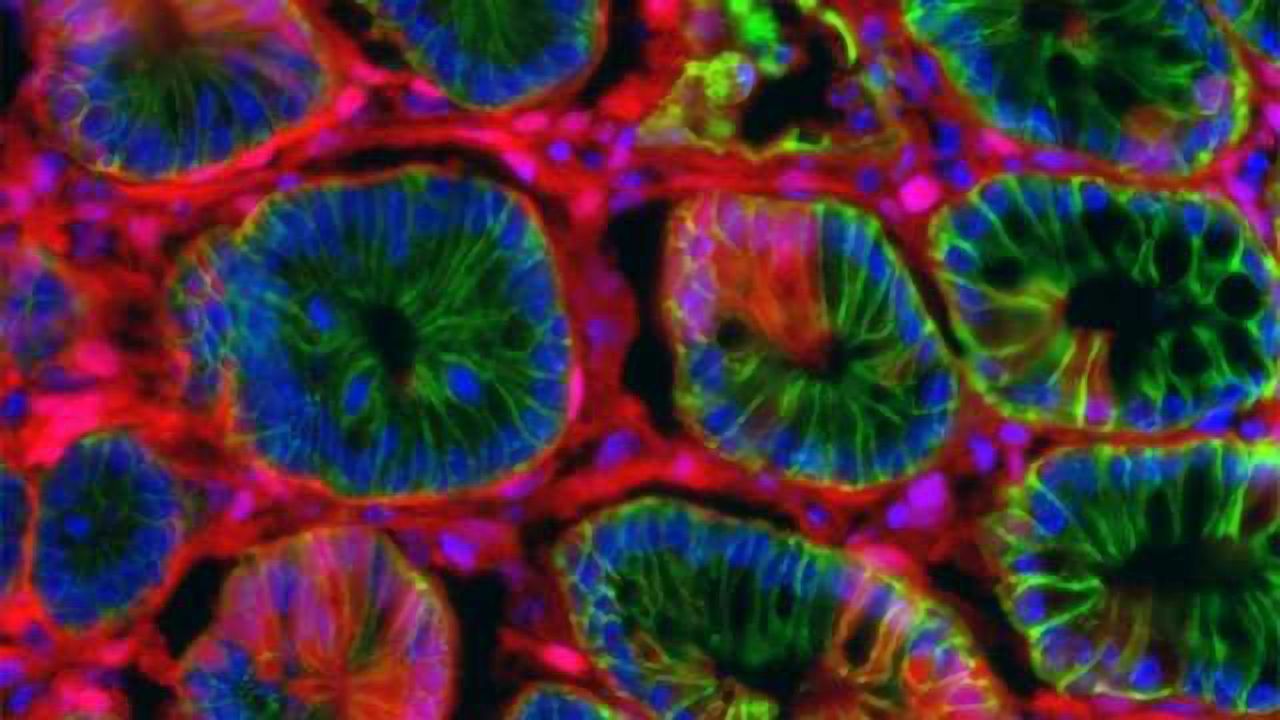 A New Model for Speeding Up Colon Cancer Research