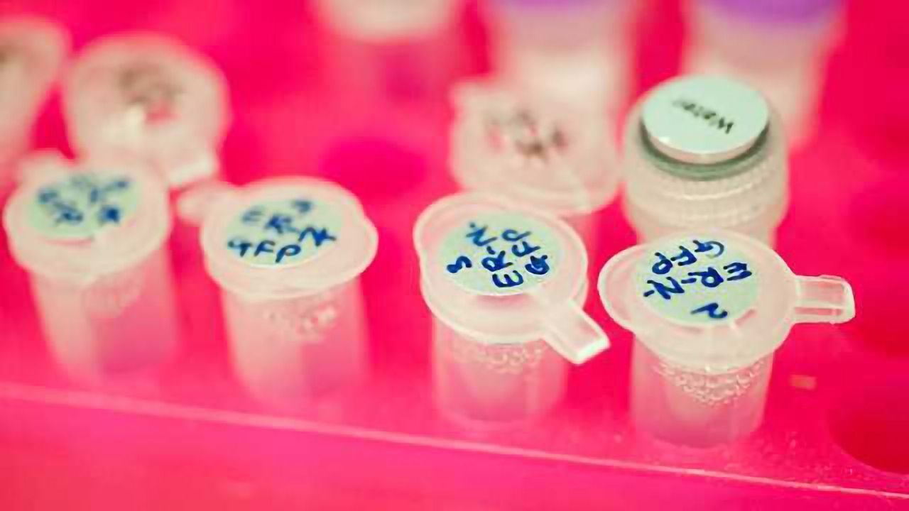 Gene Study Provides New Insights Into Childhood Overgrowth, Intellectual Disability