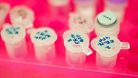 Gene Study Provides New Insights Into Childhood Overgrowth, Intellectual Disability
