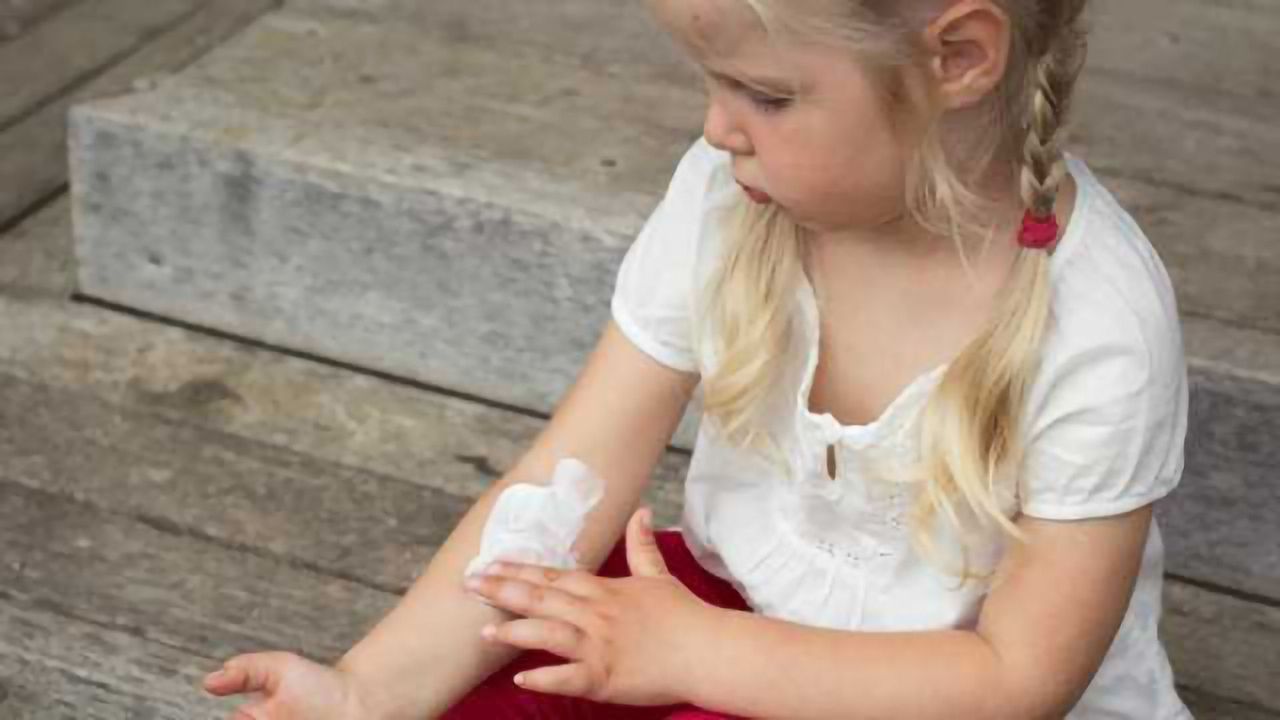 Lack of Filaggrin Triggers Eczema in Human Skin Model