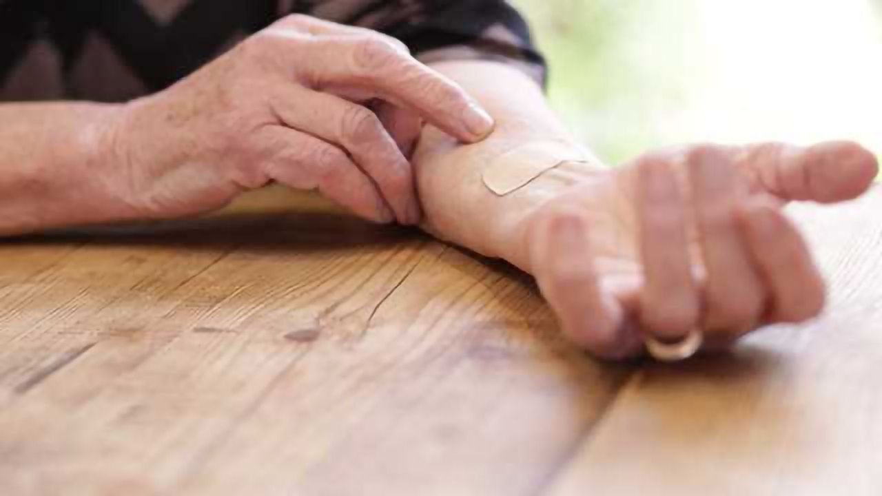 Medherant Appoints Laboratoires Plasto Santé to Manufacture Drug Delivery Patches