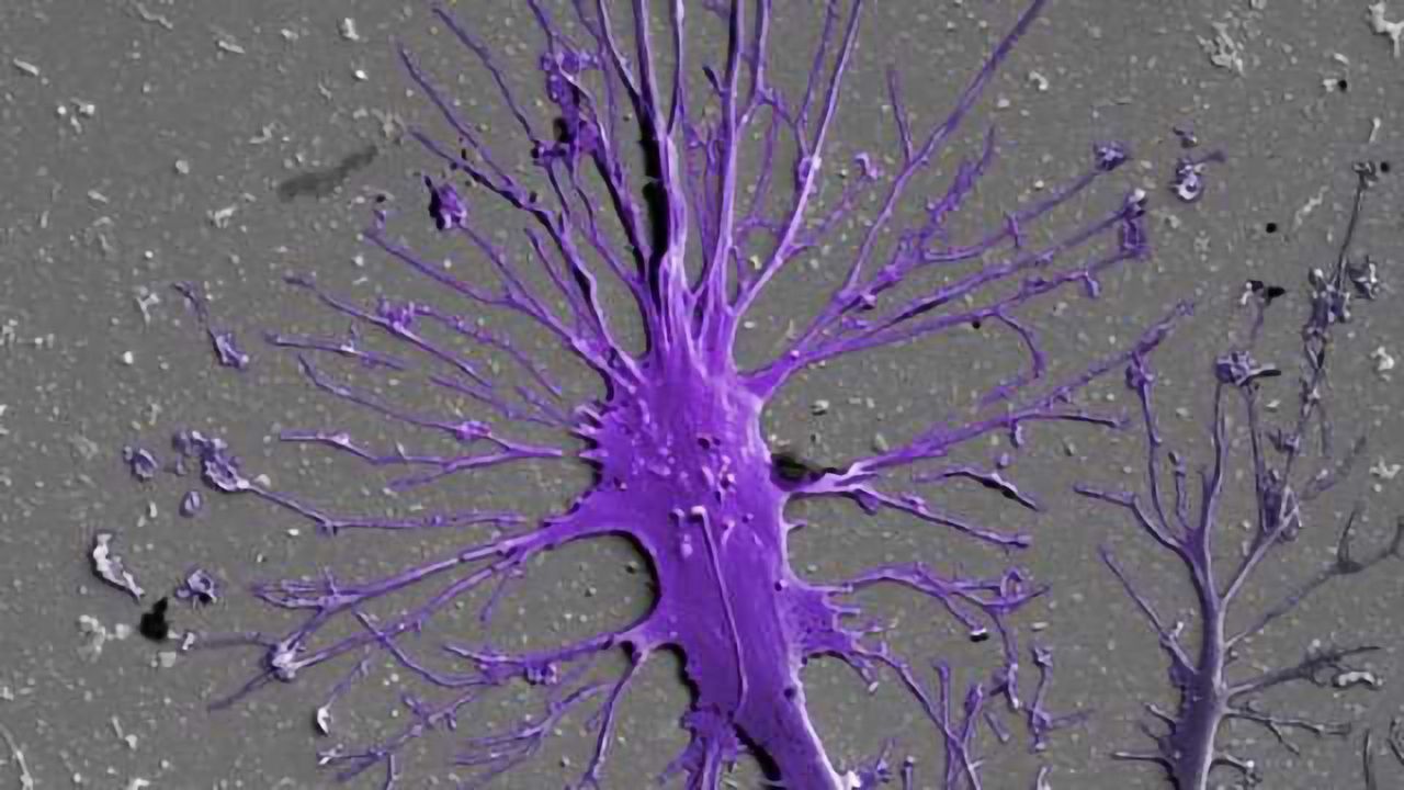 Glomerulus-on-a-Chip Created from Stem Cells