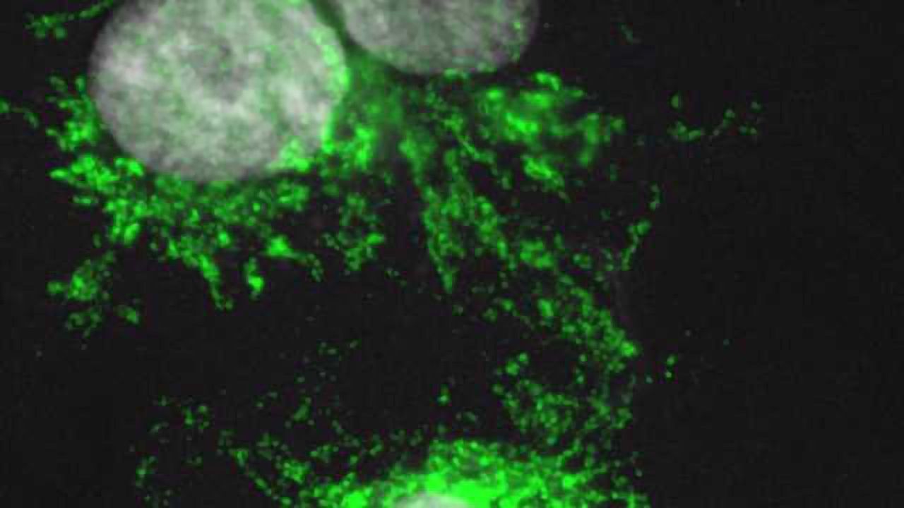 Macrophages are Key for Regeneration in Mammals