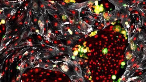 Self-Renewing Hematopoietic Stem Cells for Transplantation Created