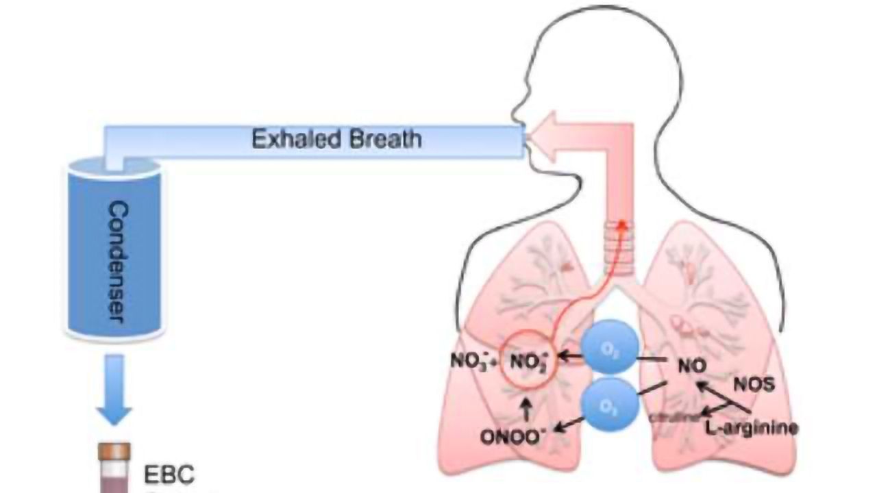 Graphene-Based Sensor Could Improve Evaluation, Diagnosis and Treatment of Asthma