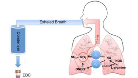 Graphene-Based Sensor Could Improve Evaluation, Diagnosis and Treatment of Asthma