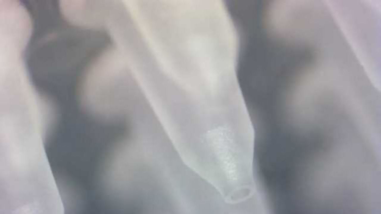 Unique Drip Geometry Improves Sample Recovery from Filtration Plates