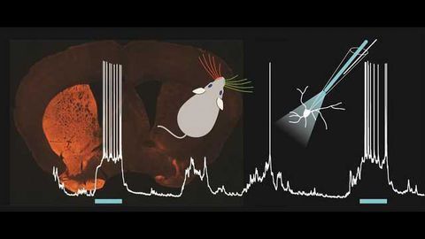 Mechanisms Behind Sensory Deficits in Parkinson's Disease Uncovered