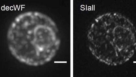Precise Insight into the Depths of Cells