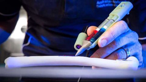 Handheld 3D Printing ‘Biopen’ Repairs Damaged Cartilage in Sheep