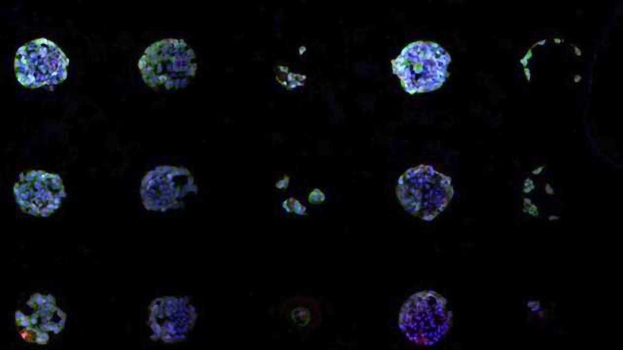 Chemical Array Finds Stemlike Cancer Cells