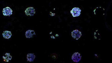 Chemical Array Finds Stemlike Cancer Cells