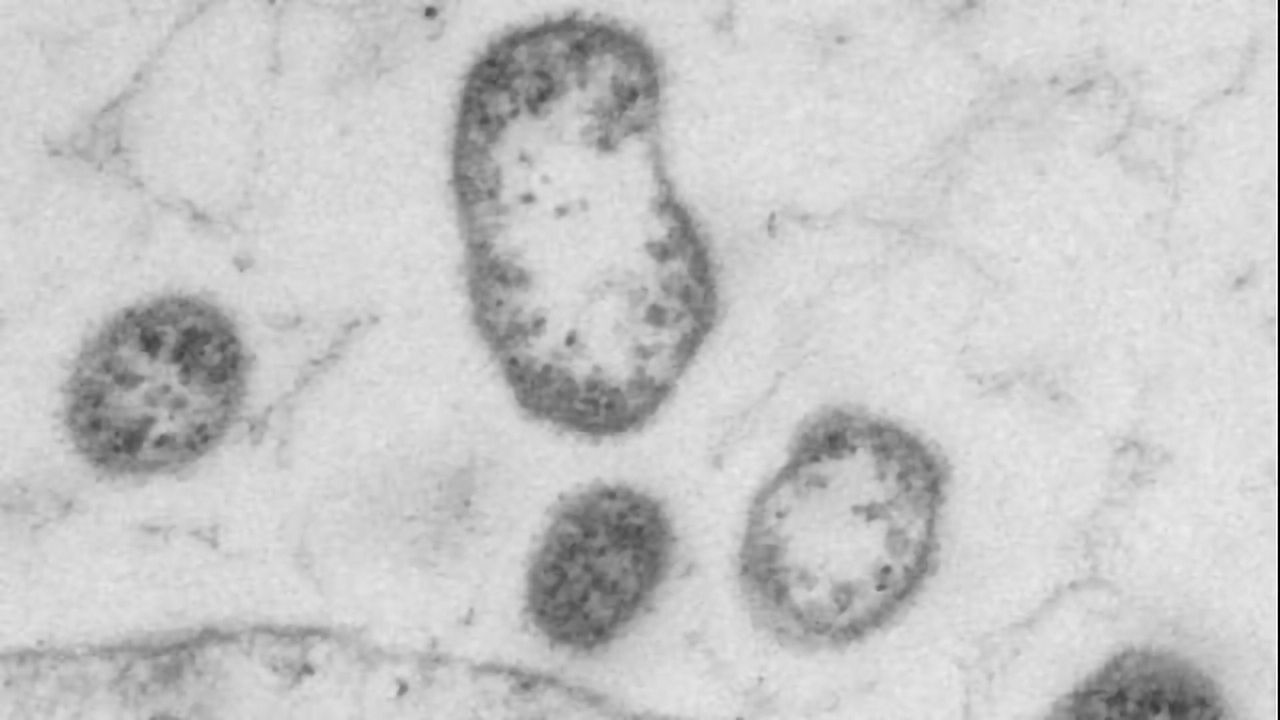 Designer Viruses Successfully Stimulate the Immune System to Fight Cancer