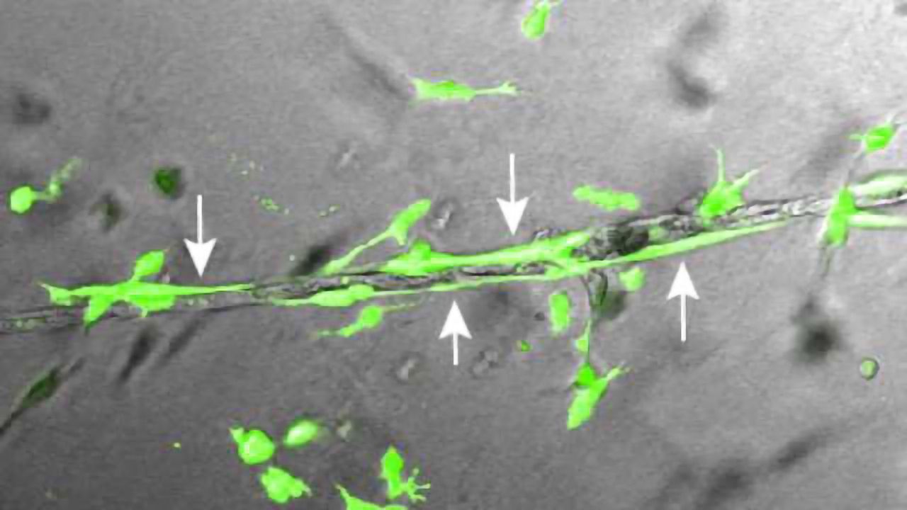 Stem Cells Yield Nature’s Blueprint for Body’s Vasculature