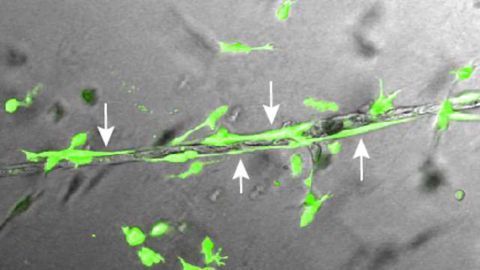 Stem Cells Yield Nature’s Blueprint for Body’s Vasculature