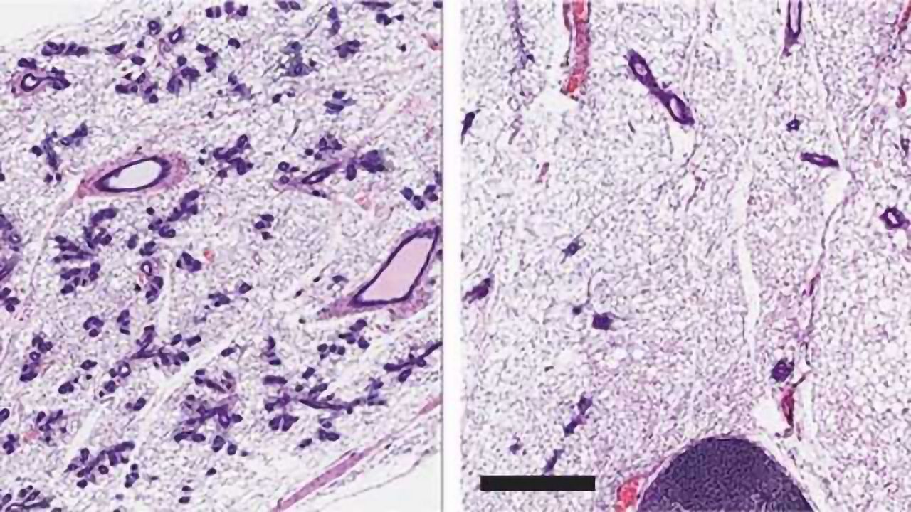 Protein Essential for Normal Mammary Stem Cell Function Identified