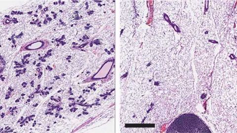 Protein Essential for Normal Mammary Stem Cell Function Identified