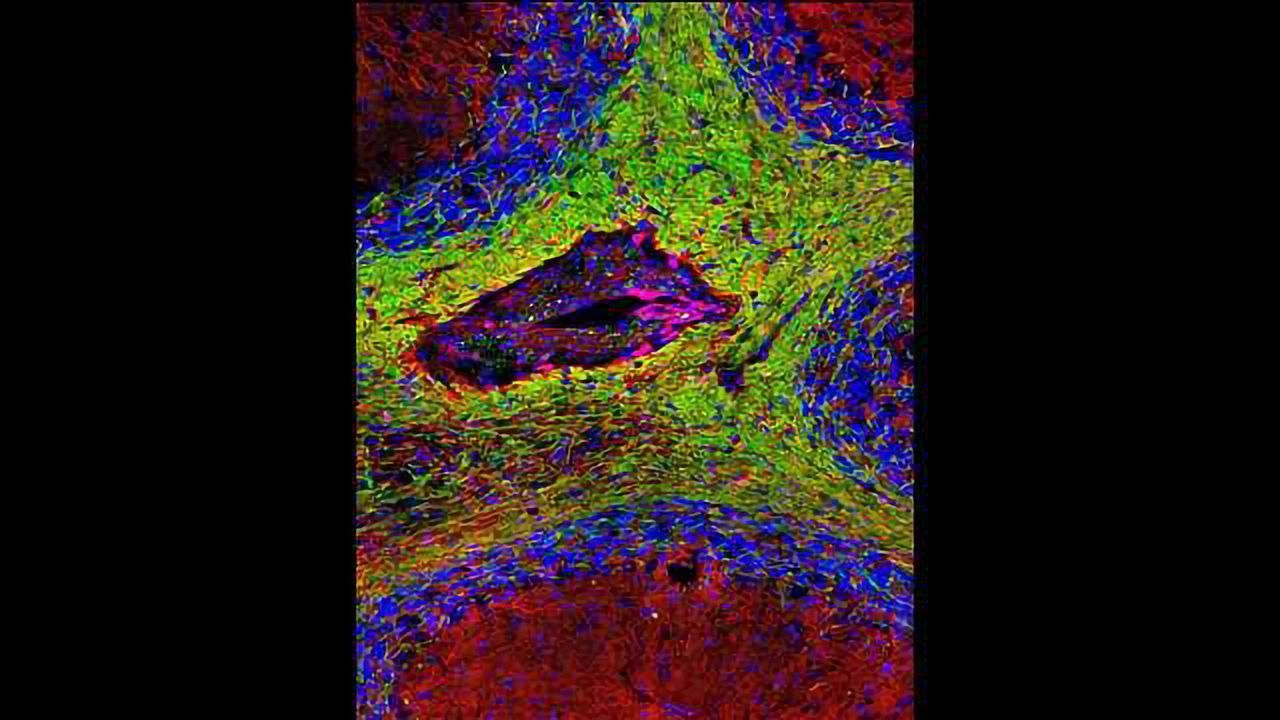 Regulatory T Cells Directly Promote Remyelination