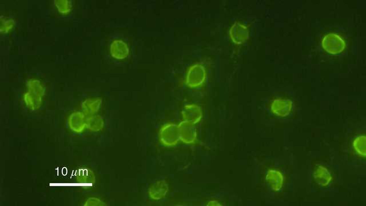 A Cryptosporidium PI(4)K Inhibitor is a Drug Candidate for Cryptosporidiosis