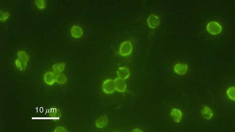 A Cryptosporidium PI(4)K Inhibitor is a Drug Candidate for Cryptosporidiosis