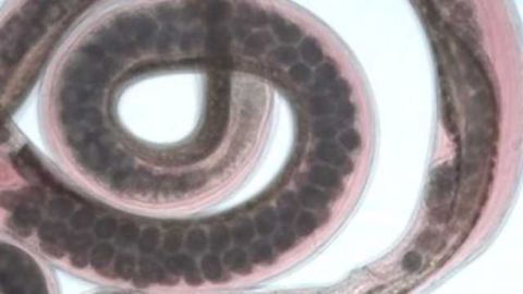 Cells Change Type to Help or Hinder Immunity