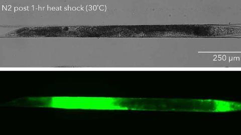 NemaMetrix Introduces Fluorescent Staining Kits for Improved Phenotyping in Model Organism C. elegans