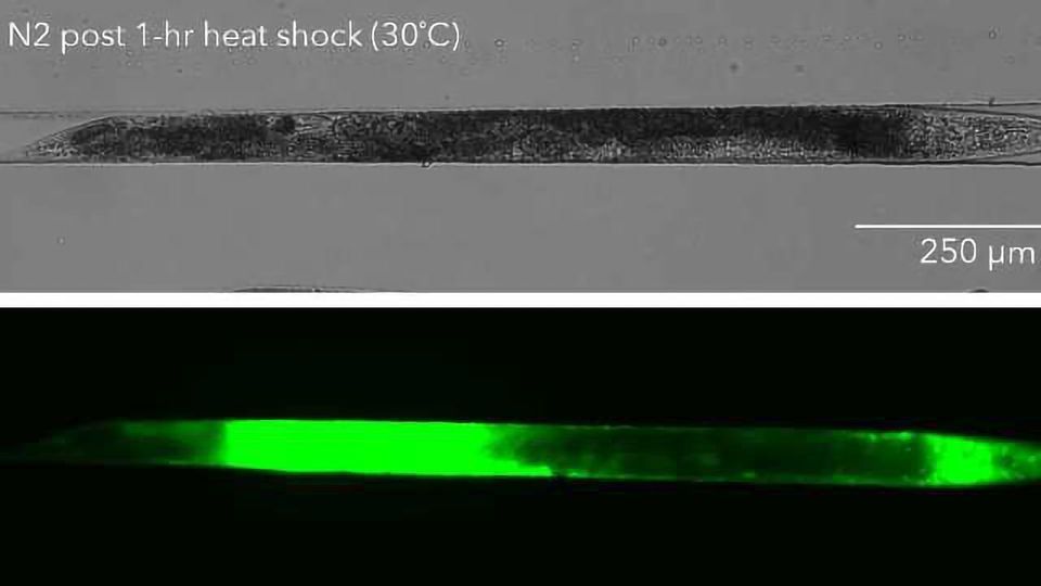 NemaMetrix Introduces Fluorescent Staining Kits for Improved Phenotyping in Model Organism C. elegans content piece image