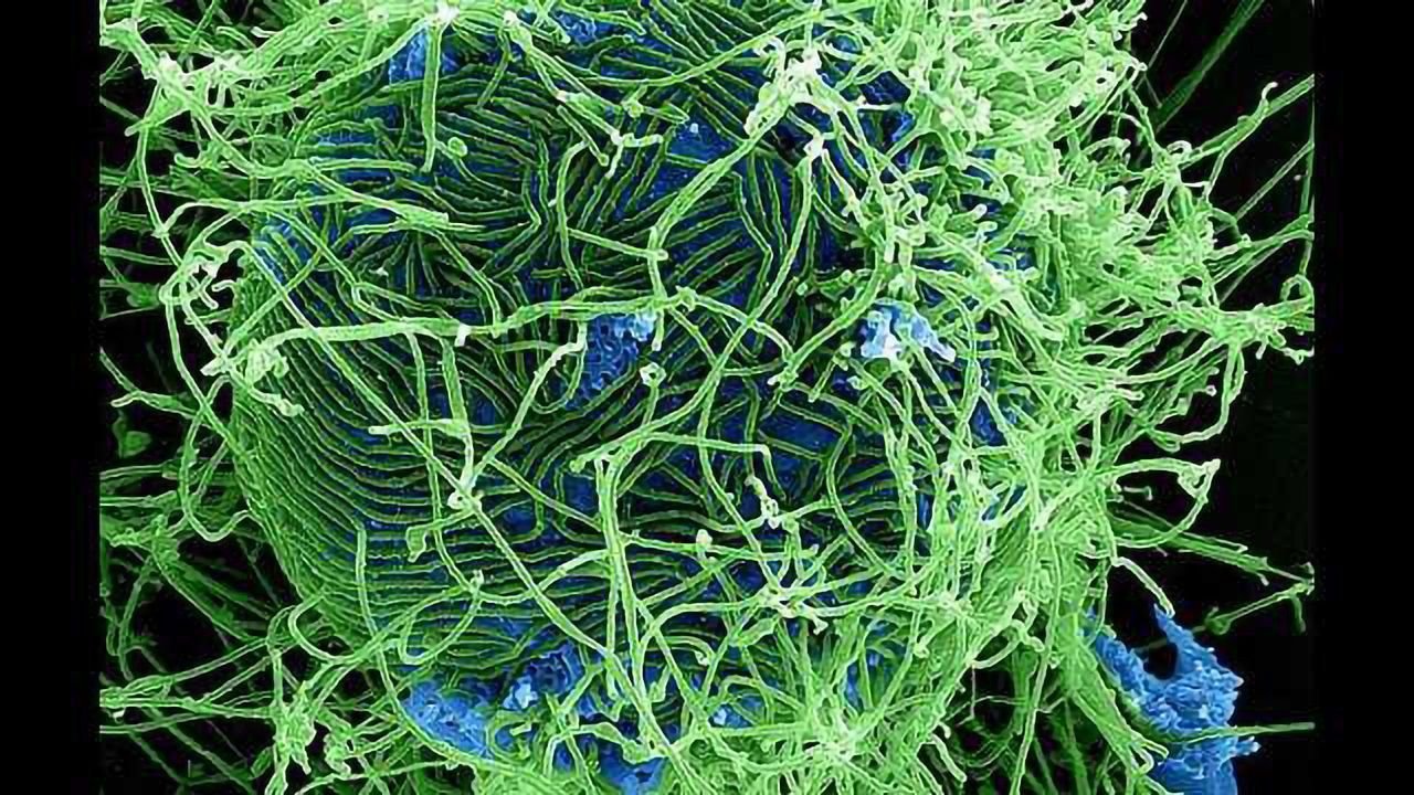 Antibodies From Ebola Survivor Could Unlock Route to Vaccines and Treatment