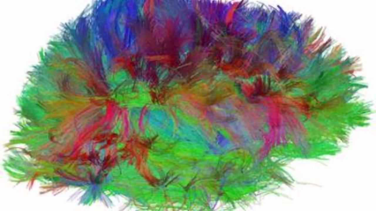 NIH Study Functionally Maps Brain Connections to Predict Autism in Infants