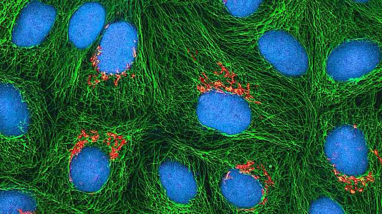 AI-driven Imaging Research Makes Diagnosing Disease Easier
