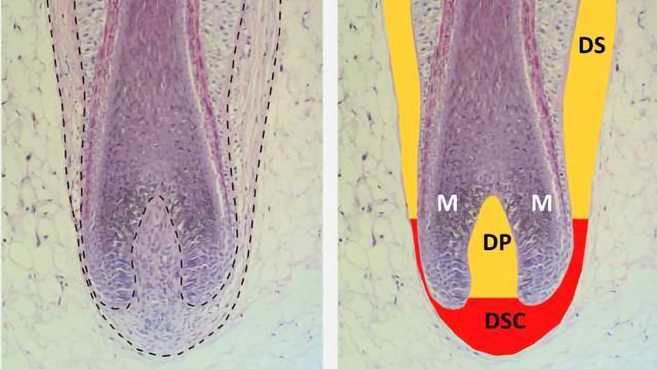 A New Approach to Treating Hair Loss