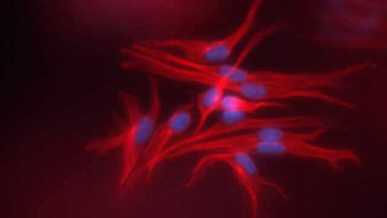 Immunofluorescence Visualization of Fibroblast or Cancer Cells in RAFT™ 3D Cell Cultures
