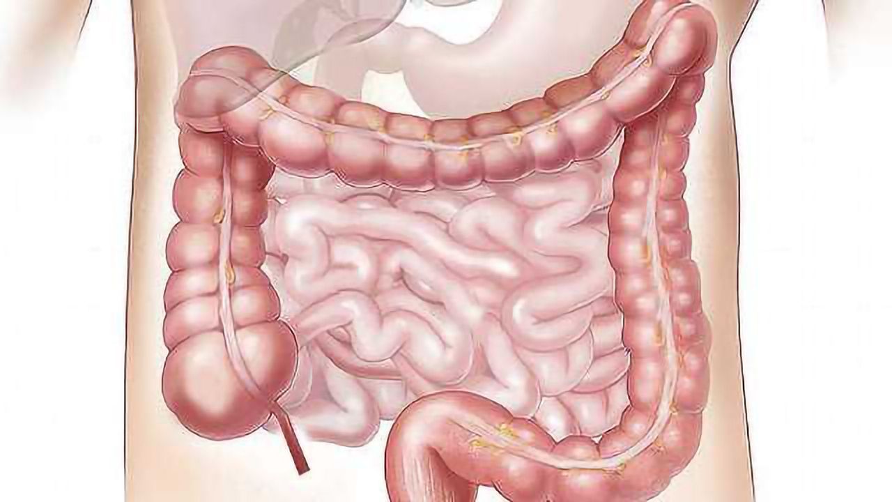 Lab Grown Human Colons Change Study of GI Disease