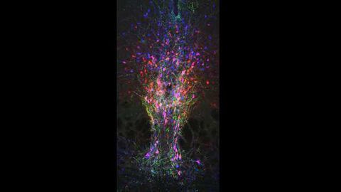 Neurocircuitry Underlying Arousal Uncovered