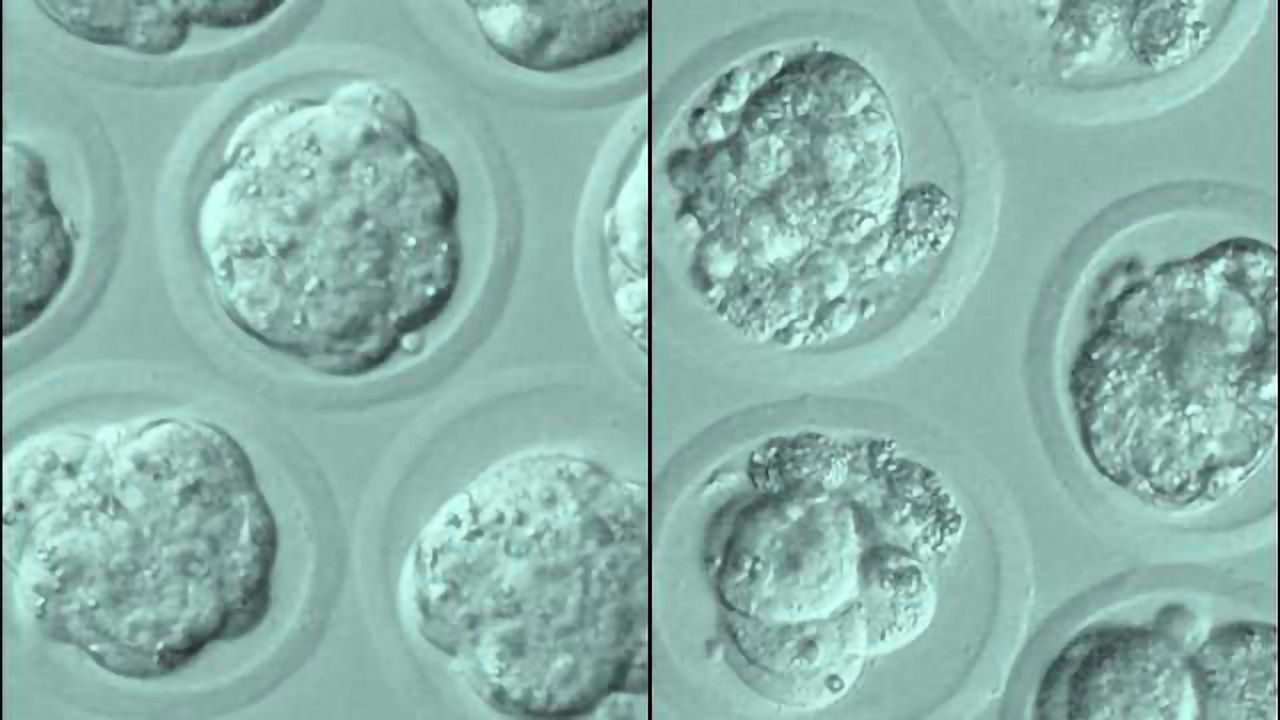 What Makes Stem Cells into Perfect Allrounders