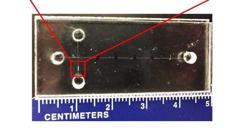 Microfluidic Chip Predicts Risk of Preterm Birth