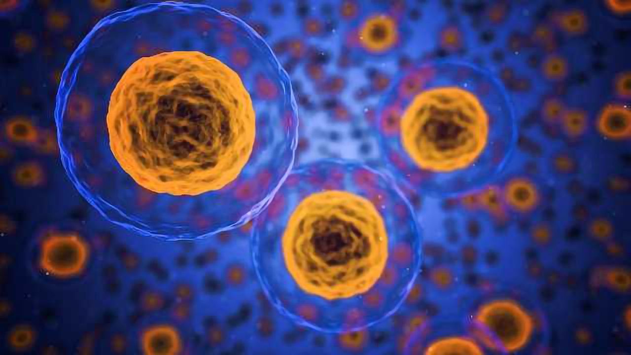 Stem Cells Play a Role in Acute Myeloid Leukemia Relapse