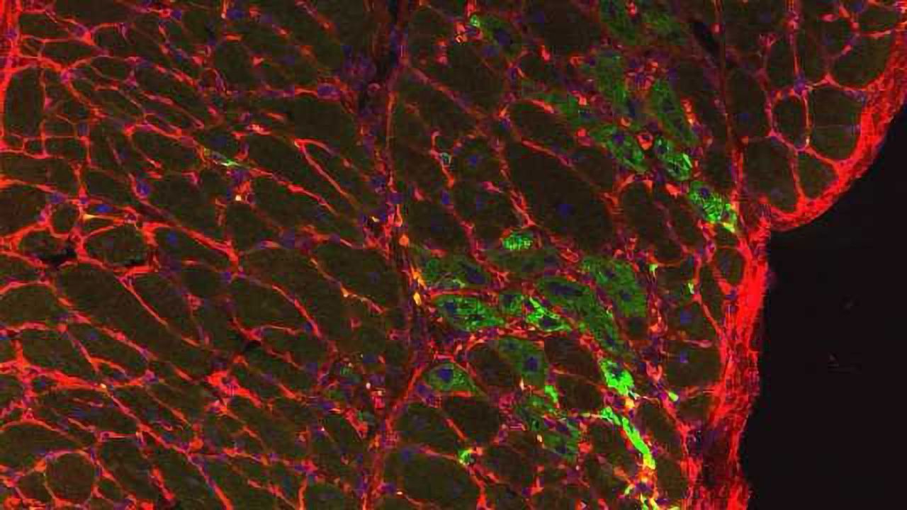 Repurposed Cancer Drug Could Treat Duchenne Muscular Dystrophy