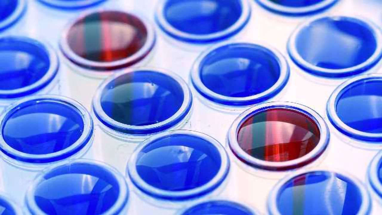 Academic Drug Discovery: Repurposing to treat disease