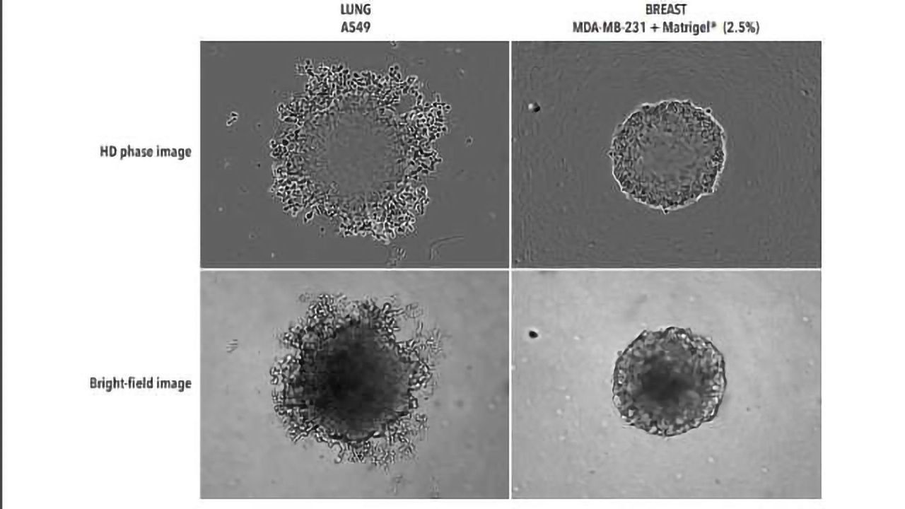 Label-free, real-time live-cell assays for spheroids: IncuCyte® bright-field analysis