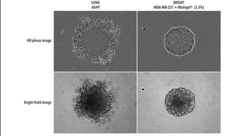 Label-free, real-time live-cell assays for spheroids: IncuCyte® bright-field analysis