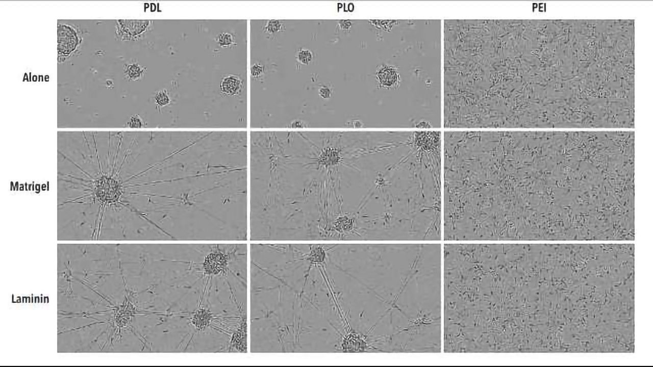 Quantitative live-cell analysis for optimization of culture conditions and evaluation of cell health in human induced pluripotent stem cell-derived neurons