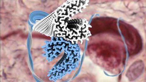 Structure of Tau Filaments from Alzheimer’s Brain Solved by Cryo-EM