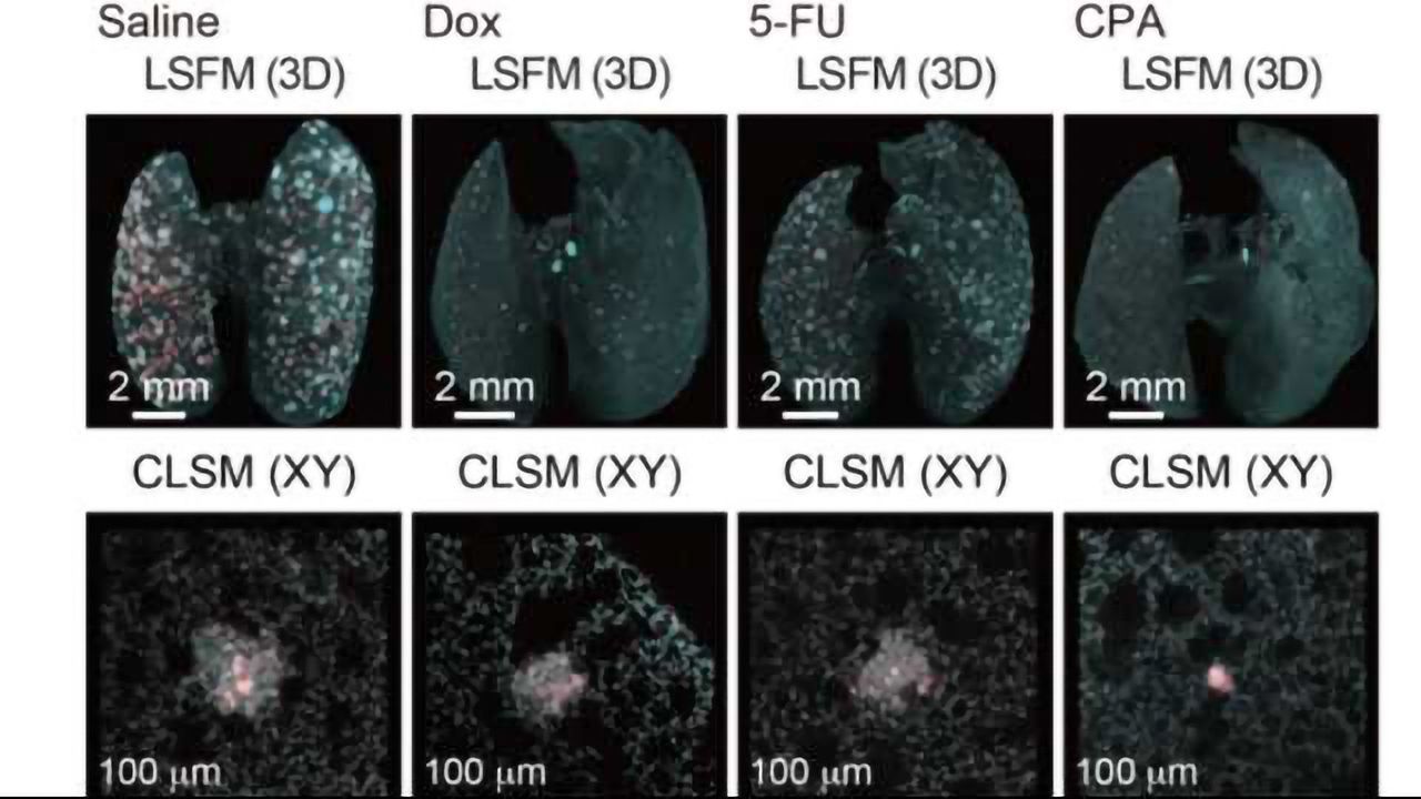 Visualizing Whole-body Cancer Metastasis at the Single-cell Level