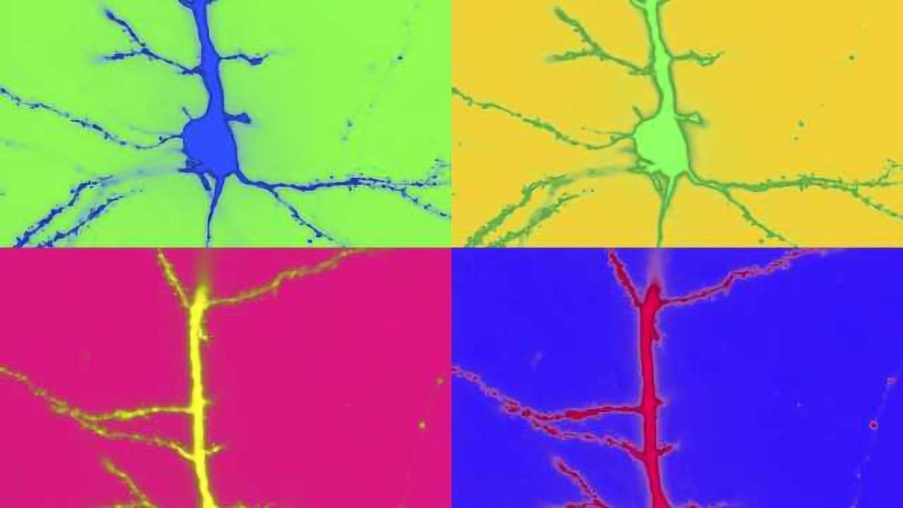 Confocal Micrograph of Layer 2/3 Pyramidal Neuron